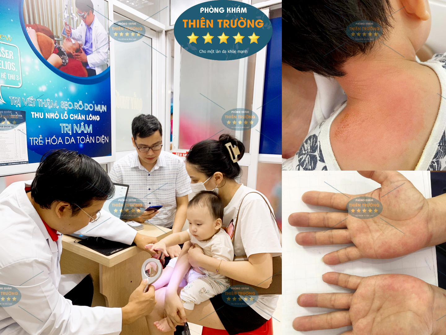 Hình ảnh: Thạc sĩ- Bác sĩ chuyên khoa II Nguyễn Tiến Thành đang khám da cho khách hàng.