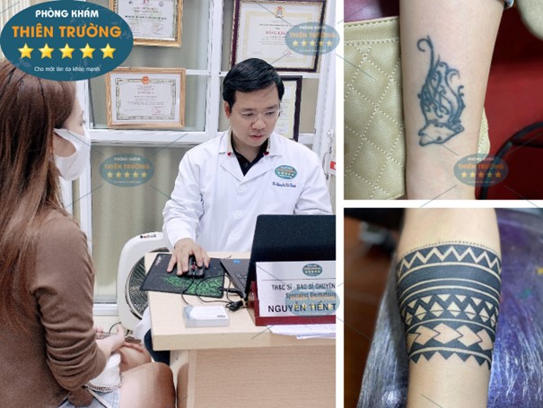 Hình ảnh: Thạc sĩ – Bác sĩ CK II Nguyễn Tiến Thành đang hỗ trợ điều trị xóa xăm cho khách hàng.