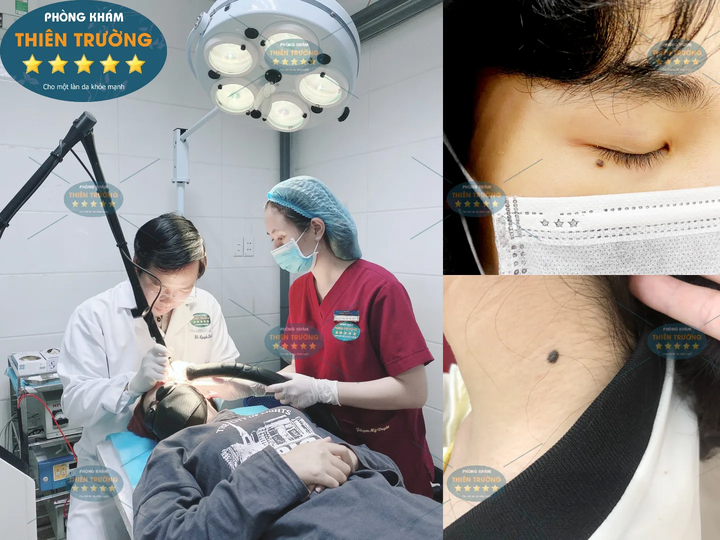 Hình ảnh: Thạc sĩ – Bác sĩ Chuyên Khoa II Nguyễn Tiến Thành tại Phòng khám Da liễu thẩm mỹ Thiên Trường