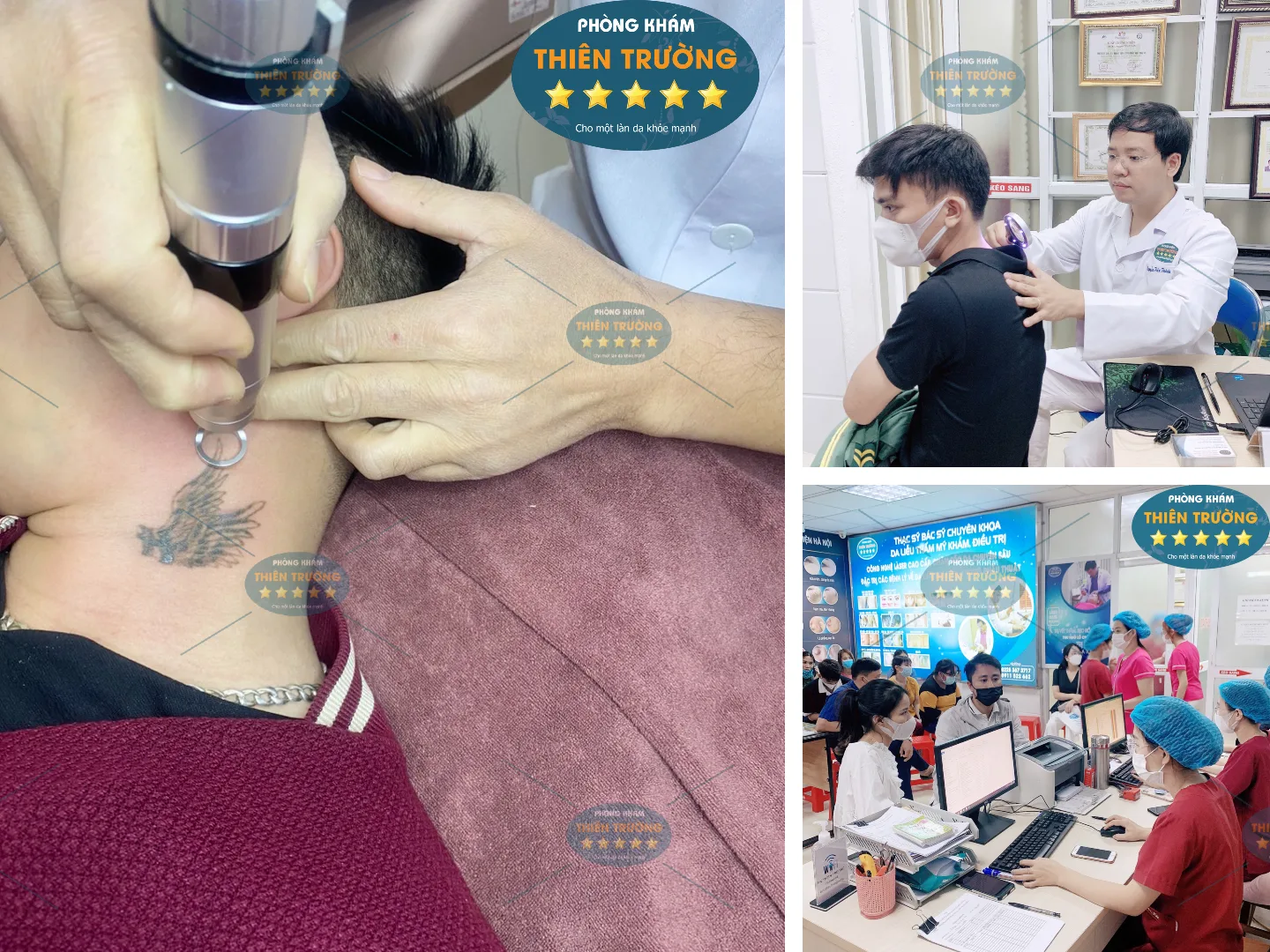 Hình ảnh: Thạc sĩ – Bác sĩ CK II Nguyễn Tiến Thành đang hỗ trợ điều trị xóa xăm cho khách hàng.