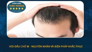 Hình ảnh: Hói đầu chữ M