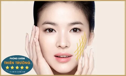 Hình ảnh : căng da mặt