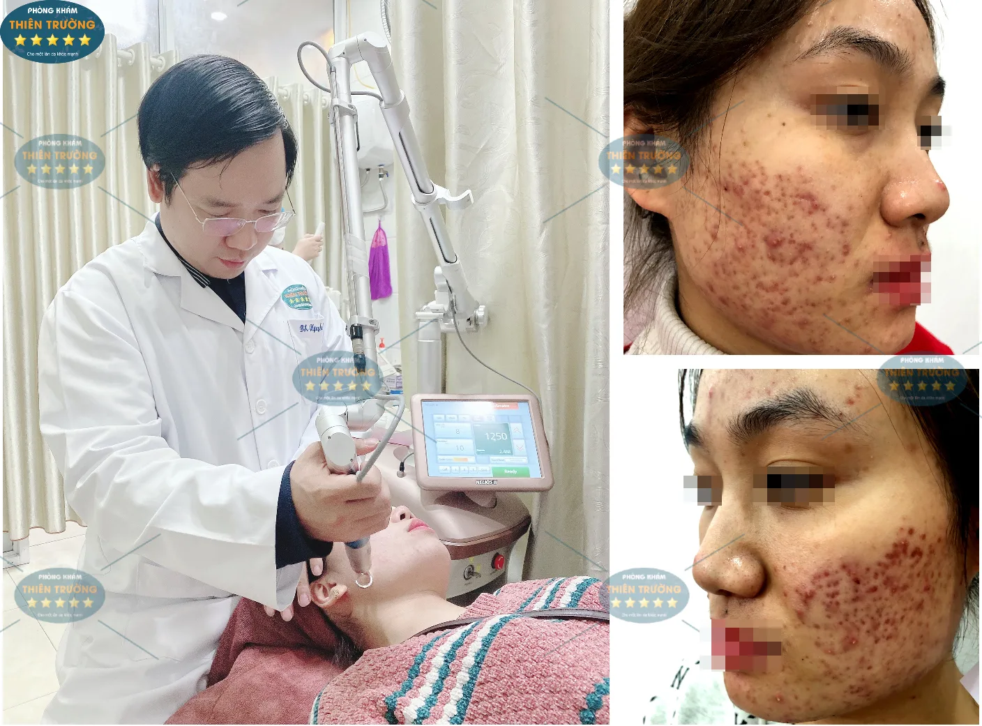 Hình ảnh: Khách hàng đang khám mụn tại phòng khám.