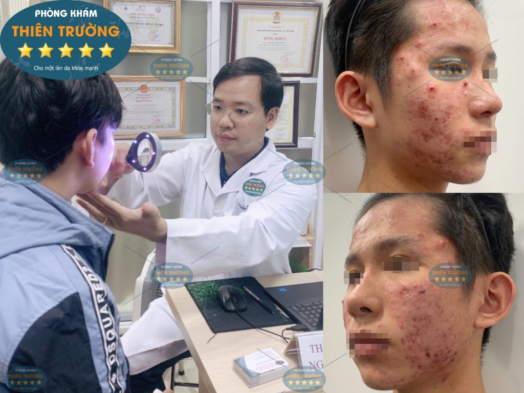 Hình ảnh: Khách hàng đang khám mụn tại phòng khám.