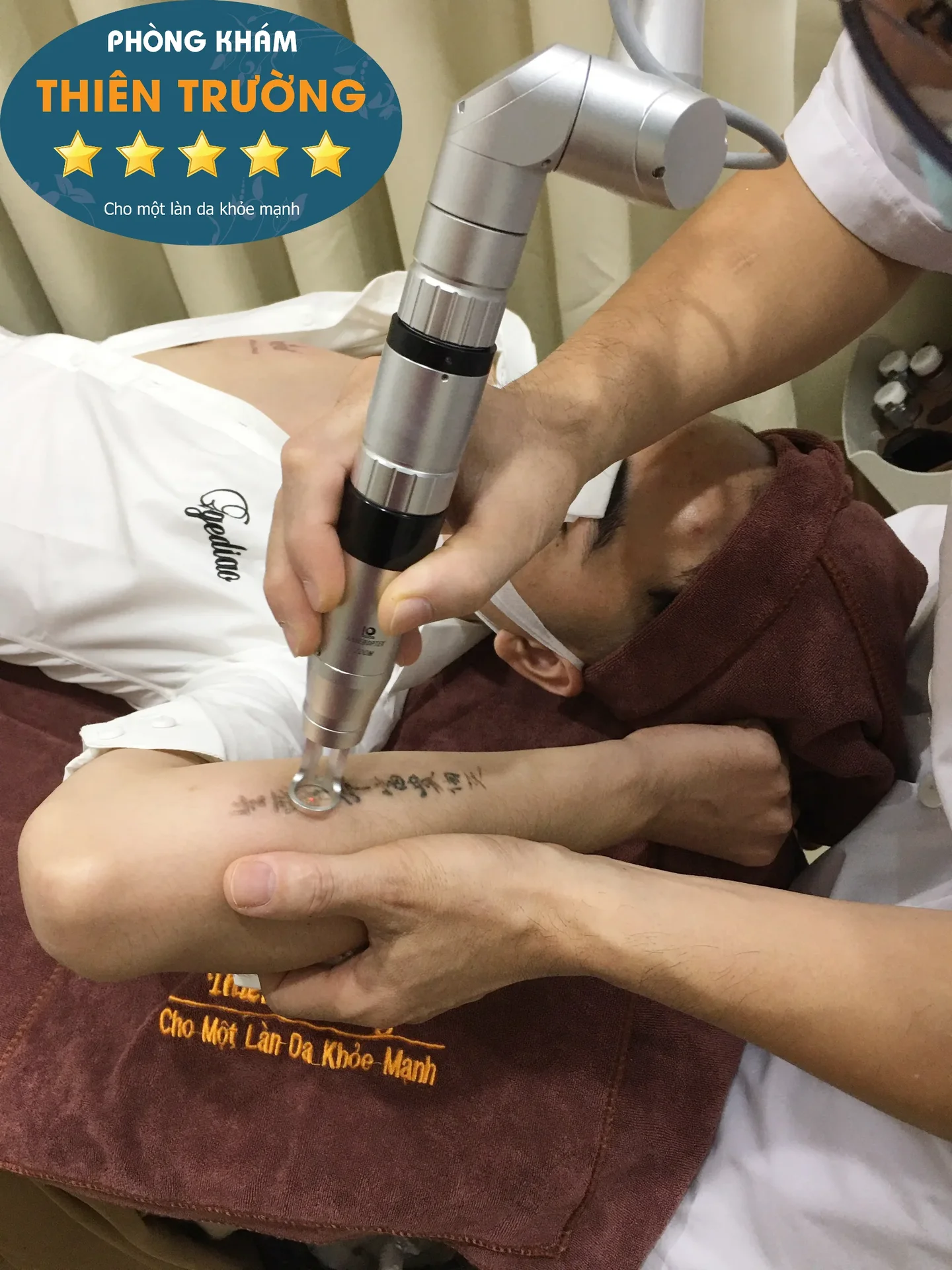Hình ảnh: xóa xăm bằng laser