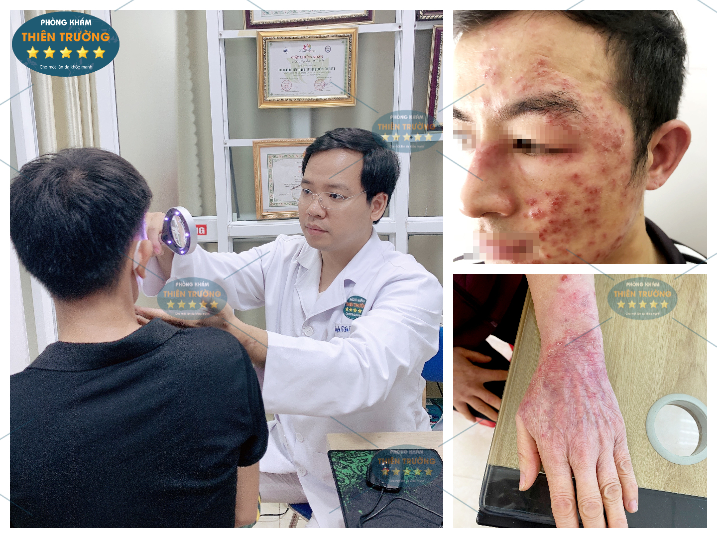 Hình ảnh: Thạc sĩ- Bác sĩ CK II Nguyễn Tiến Thành đang khám da cho bệnh nhân.