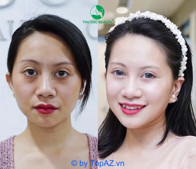 HÌnh ảnh: Khách hàng tại thẩm mỹ viện Thu Cúc.