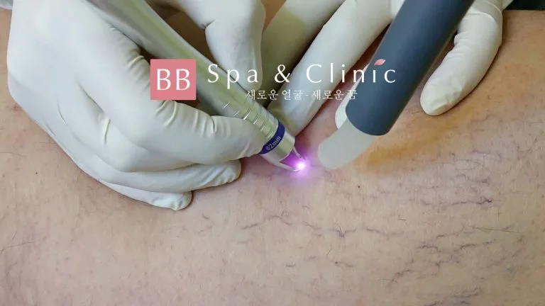 Hình ảnh: Thẩm mỹ Quốc tế BB