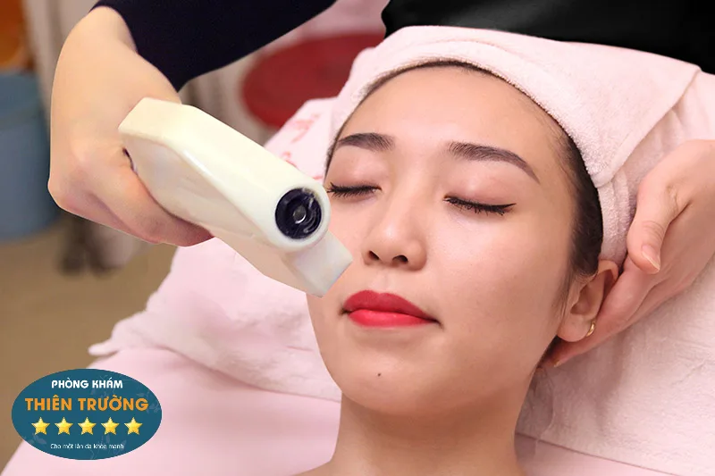 Hình ảnh : Triệt lông mặt