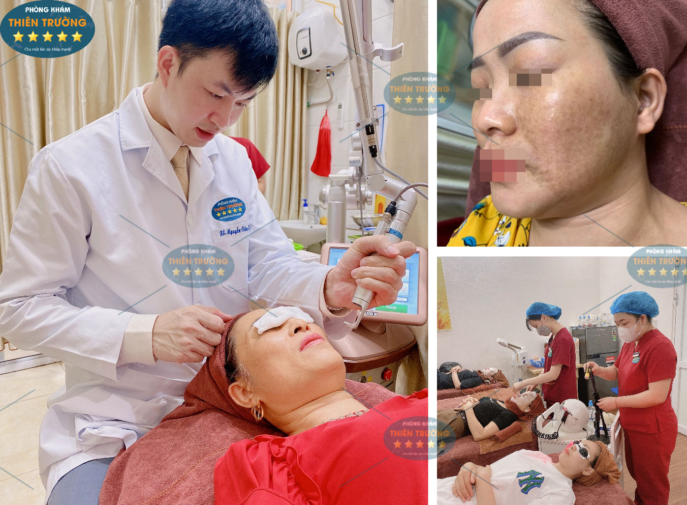 Hình ảnh: Thạc sĩ- Bác sĩ Nguyễn Văn Hoàn đang hỗ trợ điều trị nám- tàn nhang cho bệnh nhân.