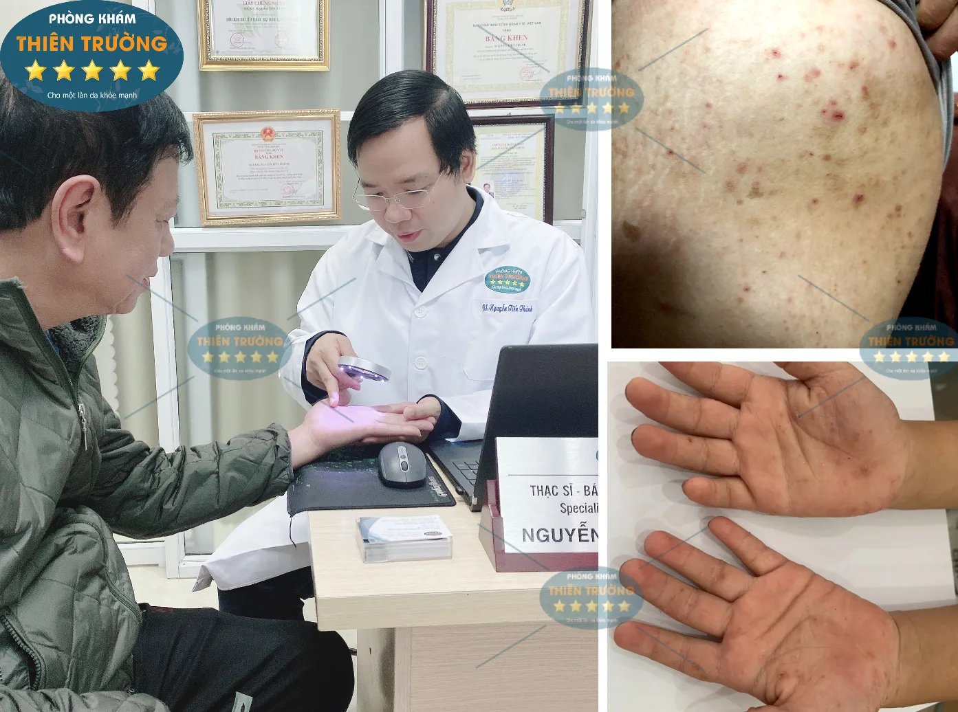 Hình ảnh: Thạc sĩ- Bác sĩ CK II Nguyễn Tiến Thành đang khám tại Phòng khám Da liễu thẩm mỹ Thiên Trường.