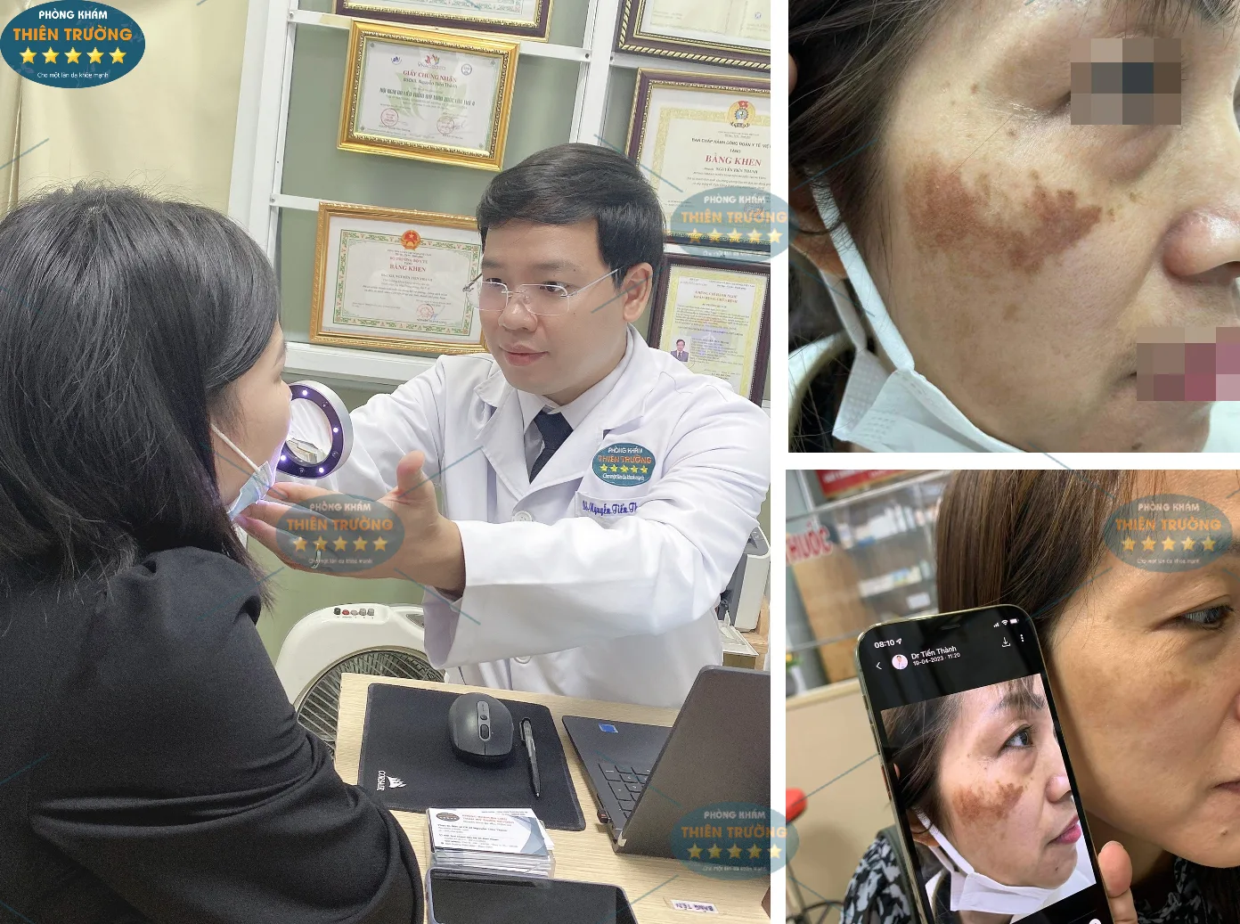 Hình ảnh: Thạc sĩ- Bác sĩ CK II Nguyễn Tiến Thành tại phòng khám Da liễu thẩm mỹ Thiên Trường.