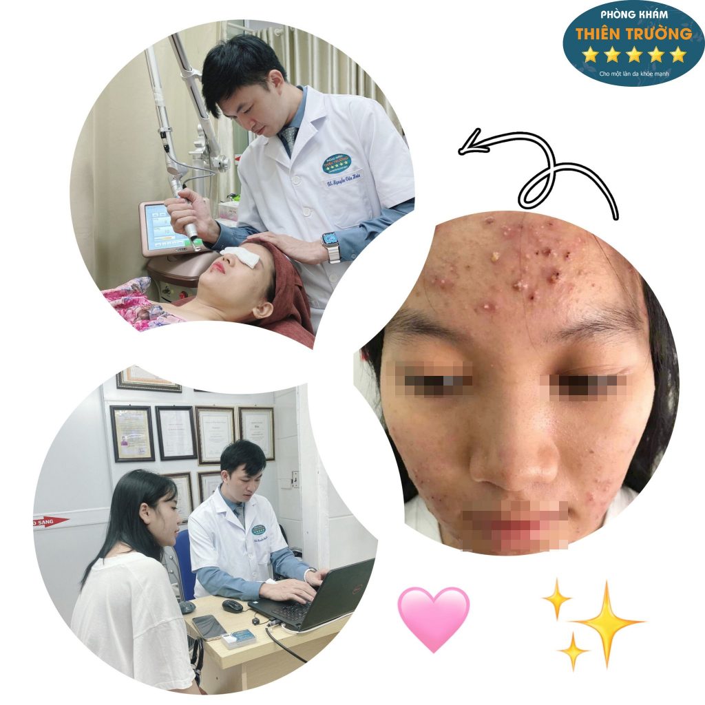 Hình ảnh: Bác sĩ thăm khám và điều trị mụn trứng cá