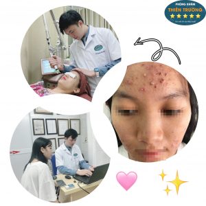 Hình ảnh: Bác sĩ thăm khám và điều trị mụn trứng cá