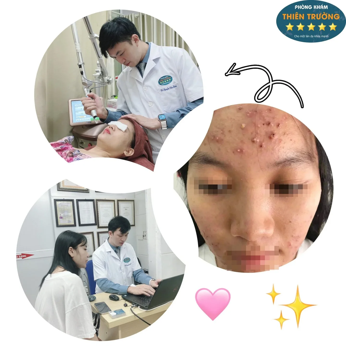 Hình ảnh: Bác sĩ thăm khám và điều trị mụn trứng cá