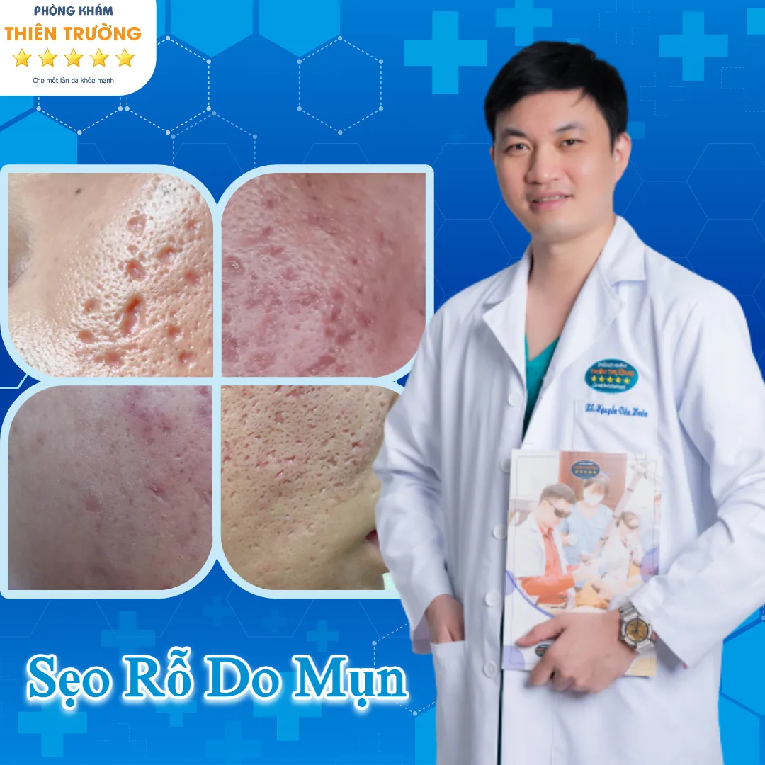 Hình ảnh: Thạc sĩ- Bác sĩ Nguyễn Văn Hoàn tại phòng khám Da liễu thẩm mỹ Thiên Trường.