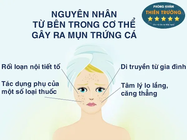 Hình ảnh : Nguyên nhân gây mụn