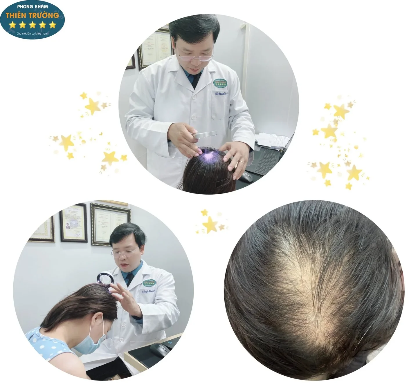 Hình ảnh: Thạc sĩ- Bác sĩ CK II Nguyễn Tiến Thành đang soi tóc cho khách hàng tại Phòng khám Da liễu thẩm mỹ Thiên Trường.