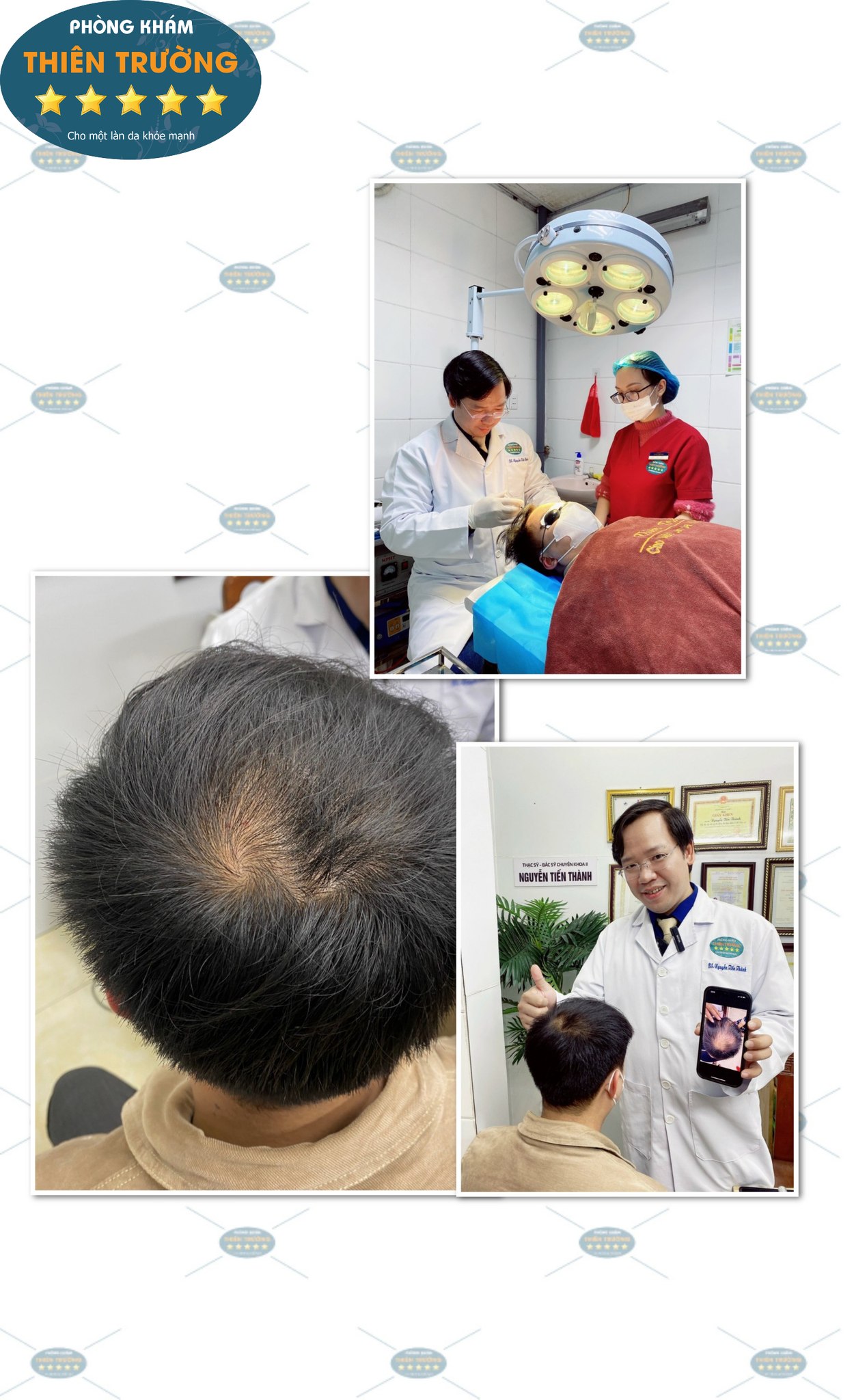 Hình ảnh: Thạc sĩ- Bác sĩ CK II Nguyễn Tiến Thành đang hỗ trợ điều trị rụng tóc cho khách hàng.