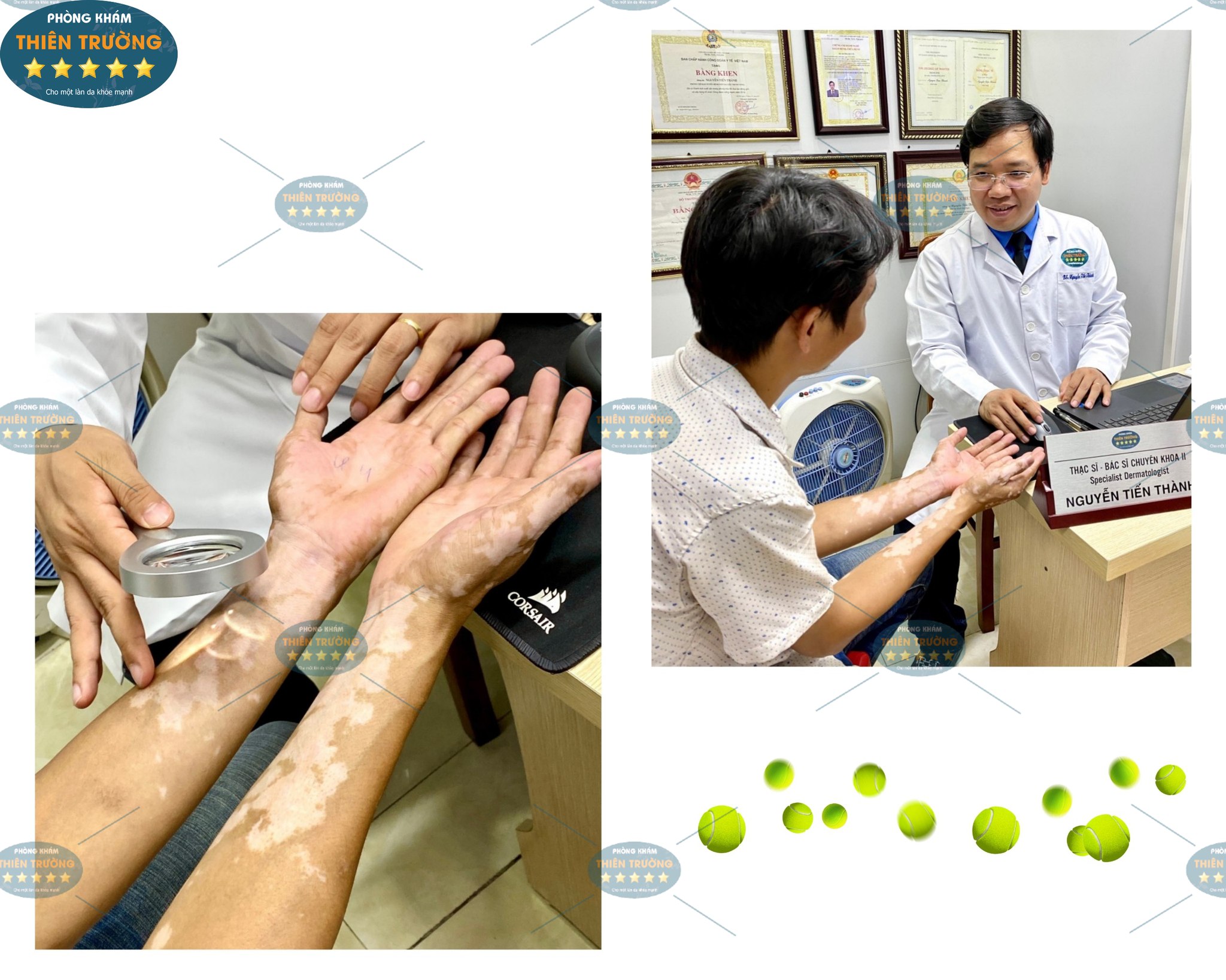 Hình ảnh: Thạc sĩ- Bác sĩ CK II Nguyễn Tiến Thành đang khám cho khách hàng bị bạch biến tại Phòng khám Da liễu thẩm mỹ Thiên Trường.