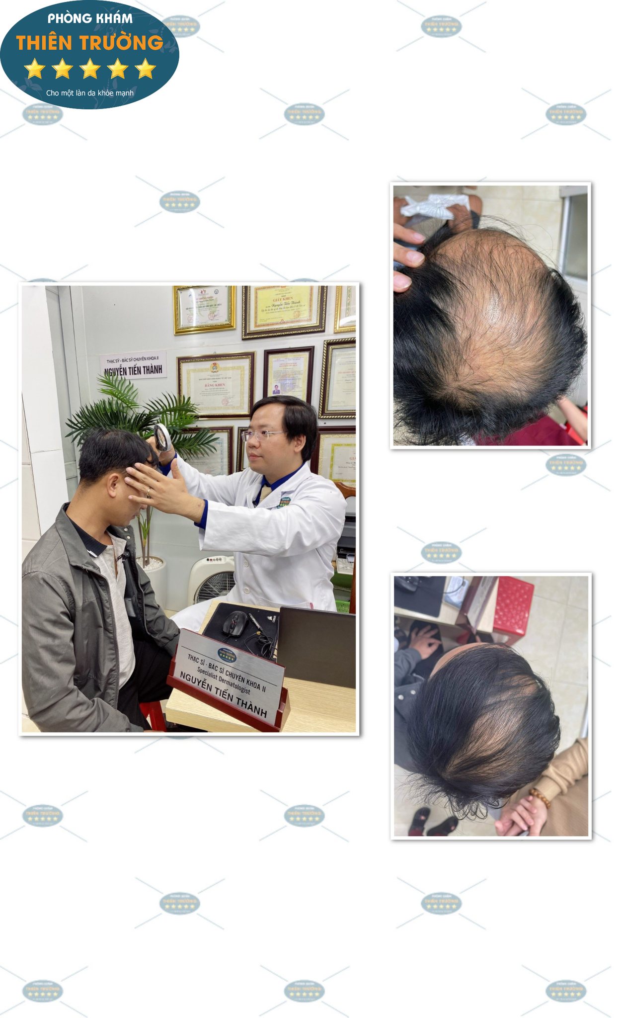 Hình ảnh: Thạc sĩ- Bác sĩ CK II Nguyễn Tiến Thành đang soi tóc cho khách hàng tại Phòng khám Da liễu thẩm mỹ Thiên Trường.