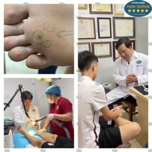 Hình ảnh : Bác sĩ da liễu thăm khám và điều trị 