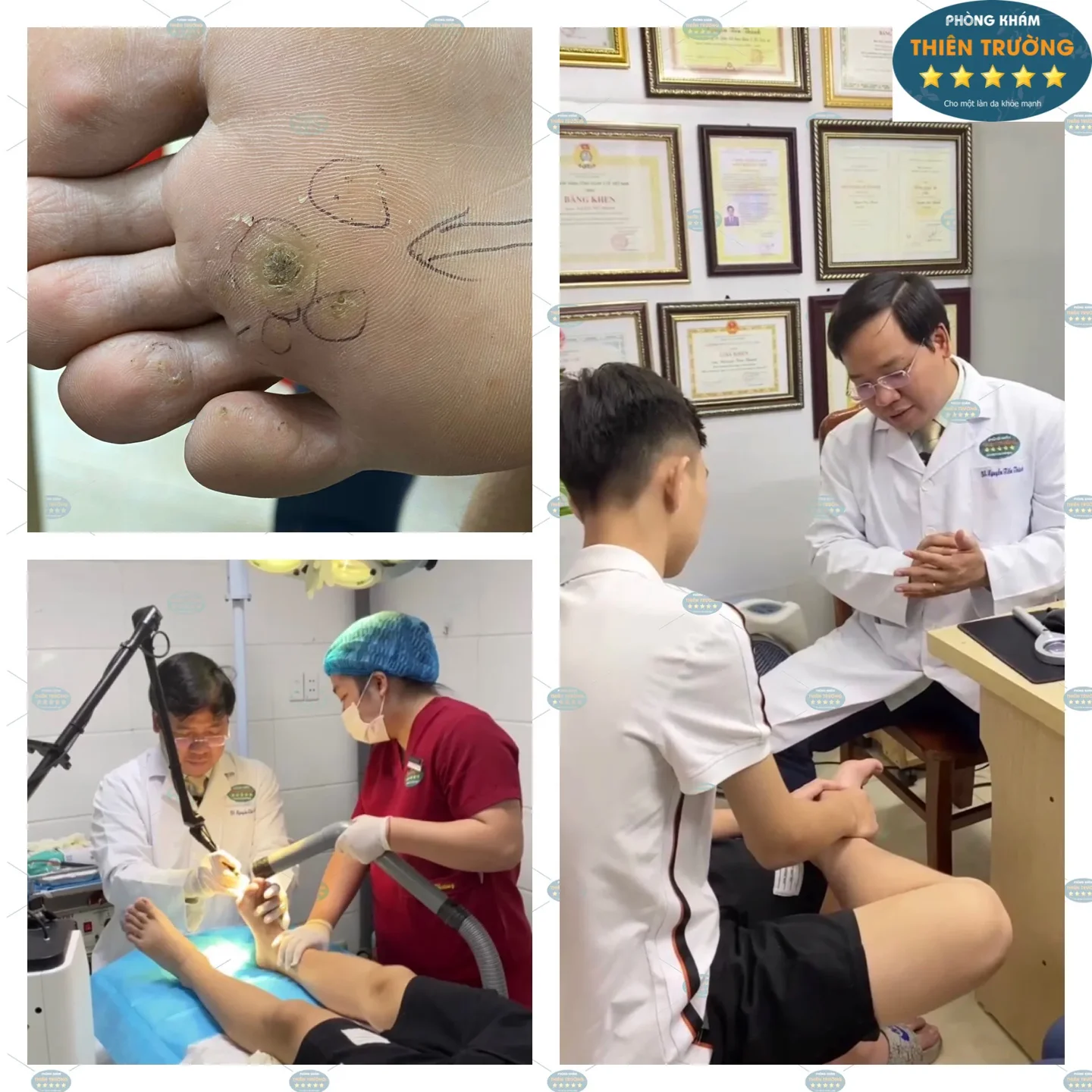 Hình ảnh : Bác sĩ da liễu thăm khám và điều trị