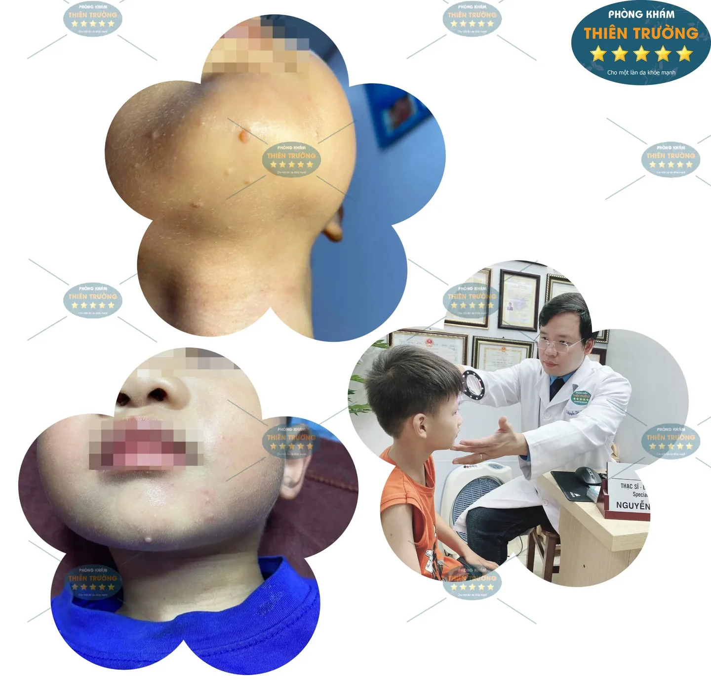 Hình ảnh: U Mềm Lây.