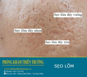 Hình ảnh: Phòng khám Da liễu thẩm mỹ Thiên Trường.