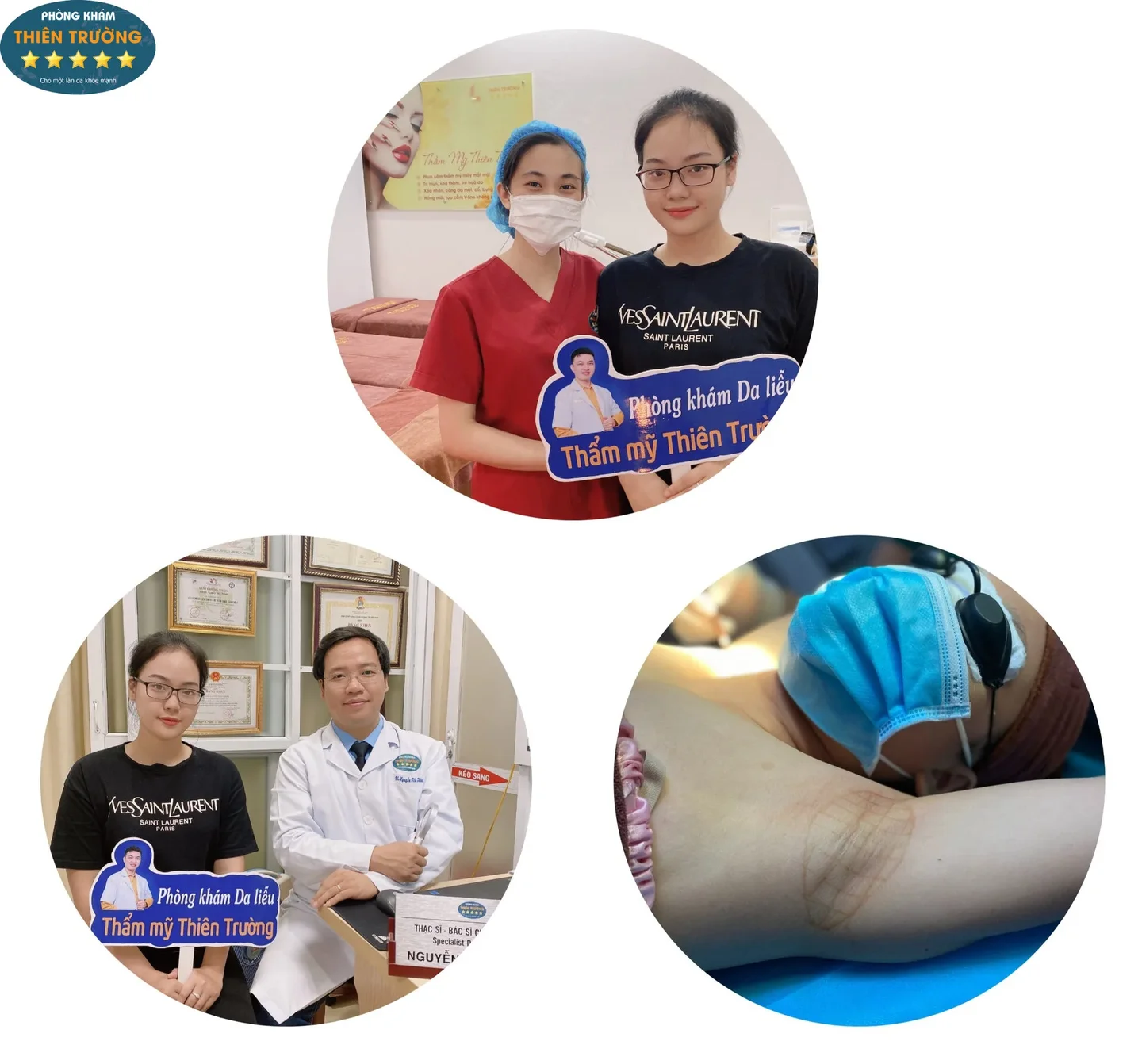 Hình ảnh: Khách hàng điều trị hôi nách.