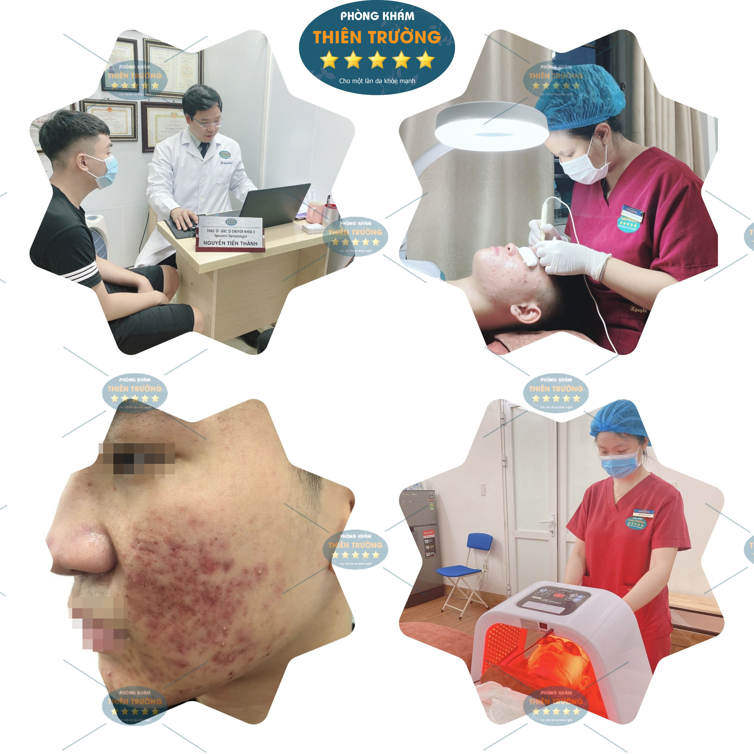 Hình ảnh: Mụn trứng cá
