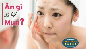 Hình ảnh : Ăn gì hết mụn trứng cá