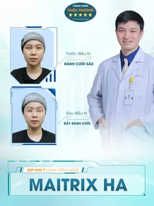 Hình ảnh: Maitrix HA.