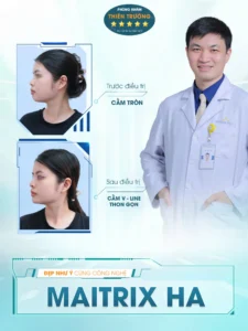 Hình ảnh: Maitrix HA.