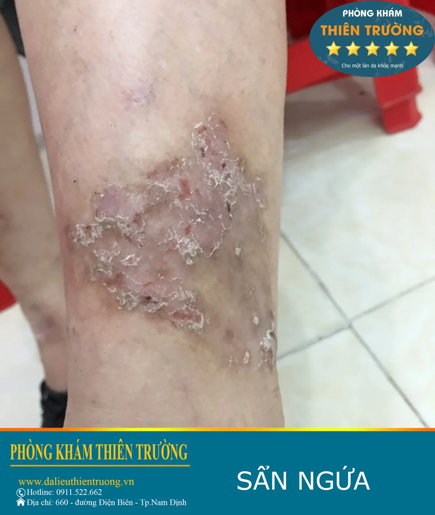 309376547_3166003653709653_8354387321620452768_n