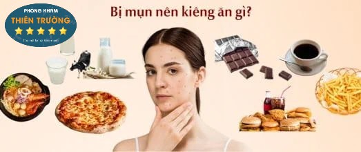 Hình ảnh : Bị mụn kiêng ăn gì.