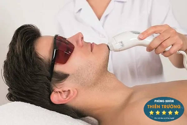 Hình ảnh: Triệt lông râu.