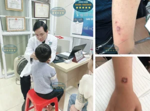 Hình ảnh: Bác sĩ Thạc sĩ Chuyên khoa II Nguyễn Tiến Thành đang thăm khám cho người bệnh