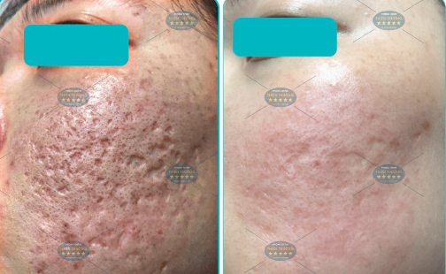 Hình ảnh : khách sau điều trị