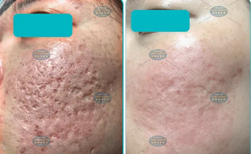 Hình ảnh : khách sau điều trị