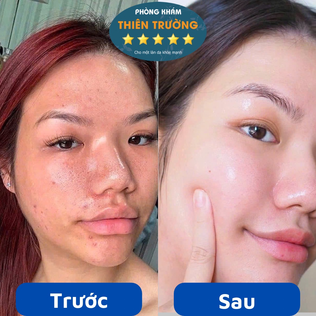 Hình ảnh : Bệnh nhân trước và sau điều trị.