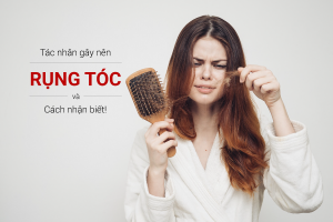 Hình ảnh : Nguyên nhân rụng tóc
