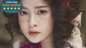 Hình ảnh : Tàn nhang