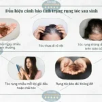 Hình ảnh: Dấu hiệu nhận biết rụng tóc.