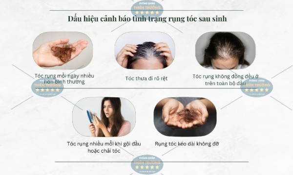 Hình ảnh: Dấu hiệu nhận biết rụng tóc.
