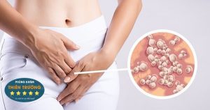 Hình ảnh: Herpes sinh dục.