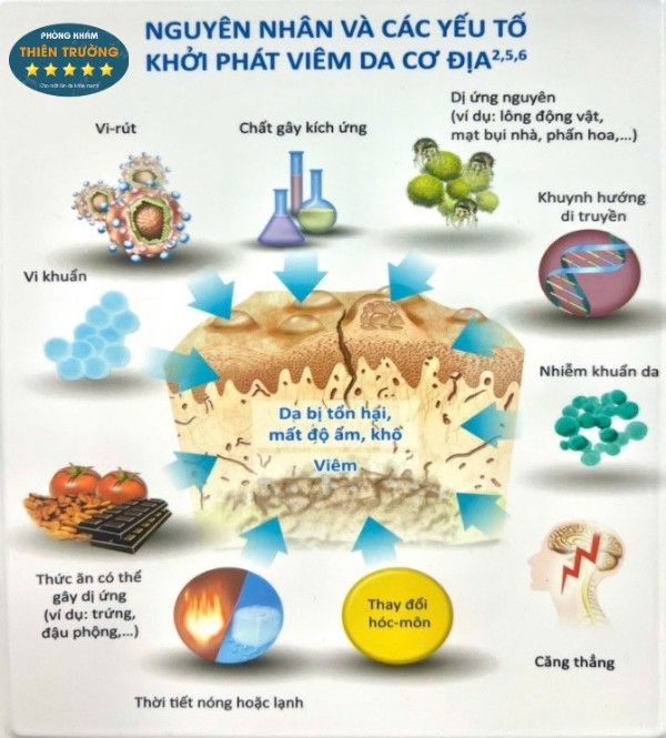 Hình ảnh : Nguyên nhân gây viêm da cơ địa.