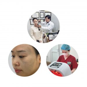 Hình ảnh : Bớt ota.