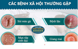 Hình ảnh: Bệnh xã hội.