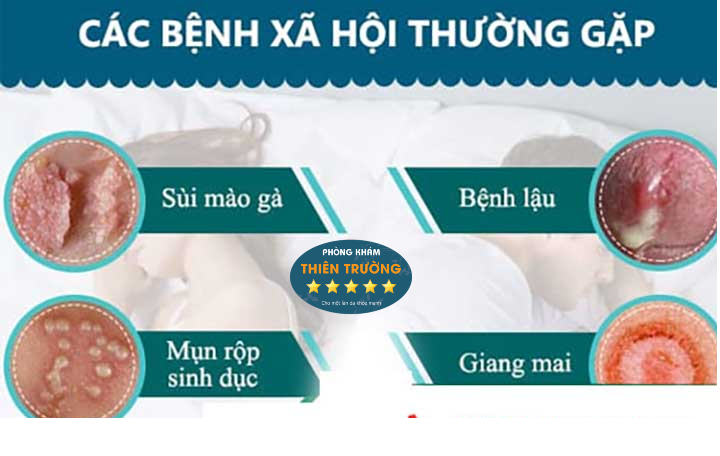Hình ảnh: Bệnh xã hội.